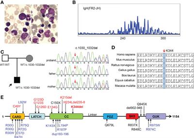 A novel CARD11 germline mutation in a Chinese patient of B cell expansion with NF-κB and T cell anergy (BENTA) and literature review